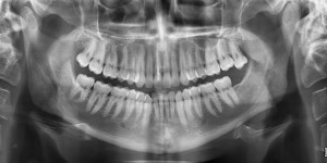 radiografie panoramica